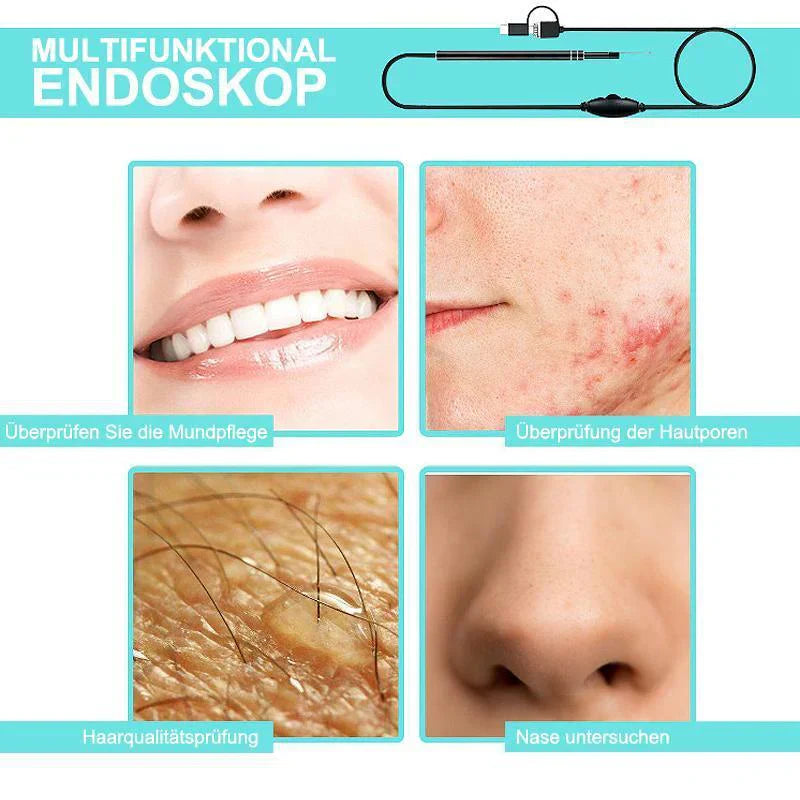 3 - In-1 Ear Cleaning Endoscope