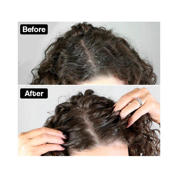 Deep Cleansing Scalp Comb